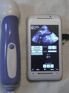 Mobisante smartphone ultrasound