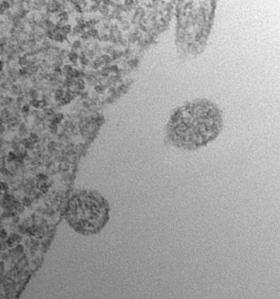 Exosome Micrograph